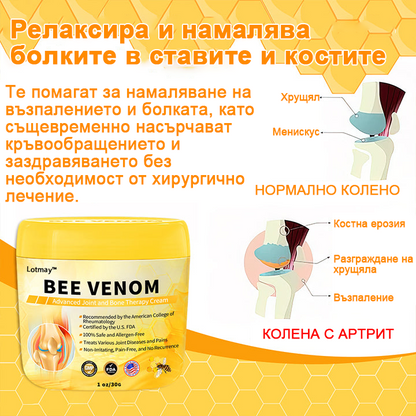 🍯𝗟𝗼𝘁𝗺𝗮𝘆™ крем с пчелна отрова за напреднала терапия на ставите и костите🐝  (специализиран за ортопедични състояния и болки в ставите)