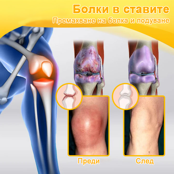 🍯𝗟𝗼𝘁𝗺𝗮𝘆™ крем с пчелна отрова за напреднала терапия на ставите и костите🐝  (специализиран за ортопедични състояния и болки в ставите)